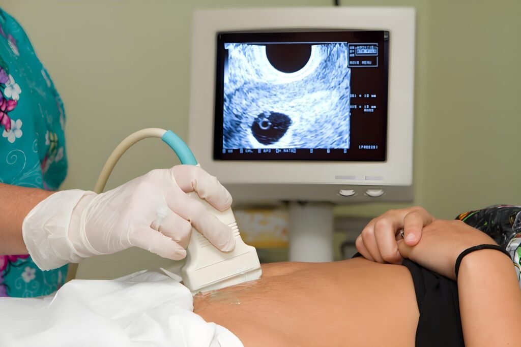 An ultrasound image showing a fetal scan.